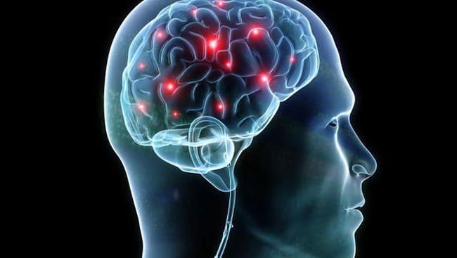 9 Suplemen Terbaik Penunjang Kesehatan Otak