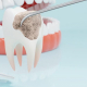Dampak Buruk Infeksi Gigi yang Telah Menyebar